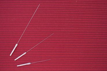 Dry Needling